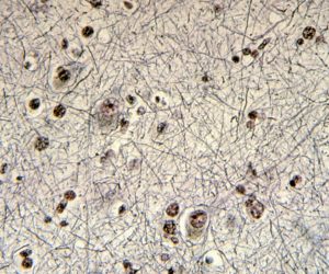 Neurofilaments in Normal Human Cortex Bodian stain showing Neurofilaments in Normal Human Cortex