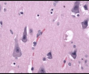 Normal Neurons normal neurons on pathology slide