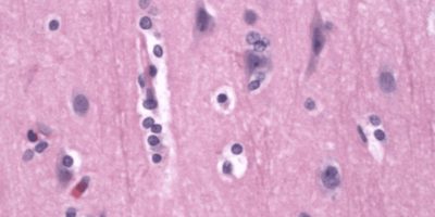 Normal Astrocytes normal Astrocytes in gray matter on H&E stain
