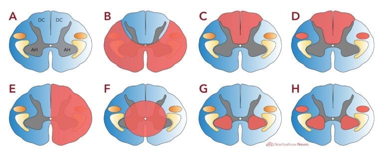 Spinal Cord and Spine Anatomy Review | Chapter and Practice Questions